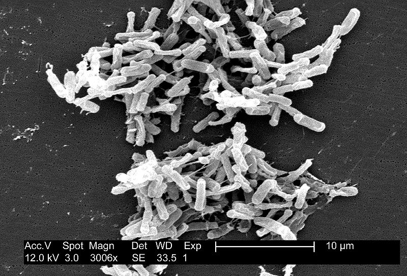 Scanning electron micrograph of Clostridium difficile, from https://en.wikipedia.org/wiki/File:Clostridium_difficile_01.jpg, originally from the US CDC web site