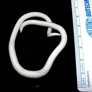 Ascaris lumbricoides, the large roundworm commonly parasitizing humans, from https://commons.wikimedia.org/wiki/File:Ascaris_lumbricoides.jpeg