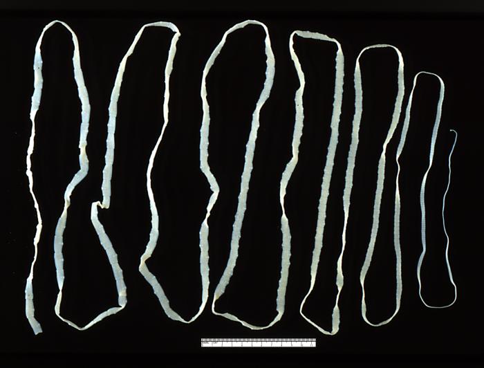Taenia saginata (synonym Taeniarhynchus saginatus), commonly known as the beef tapeworm. From https://en.wikipedia.org/wiki/Taenia_saginata#/media/File:Taenia_saginata_adult_5260_lores.jpg which comes from the Centers for Disease Control and Prevention, http://phil.cdc.gov/PHIL_Images/20031208/87d4bff74e41427cb278526bd9cbe76a/5260_lores.jpg