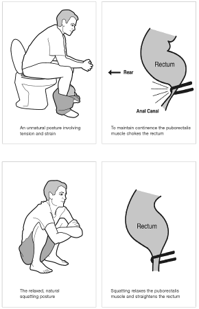 The relaxed natural squatting position for bowel movements.